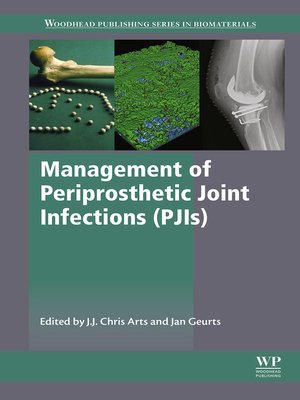 cover image of Management of Periprosthetic Joint Infections (PJIs)